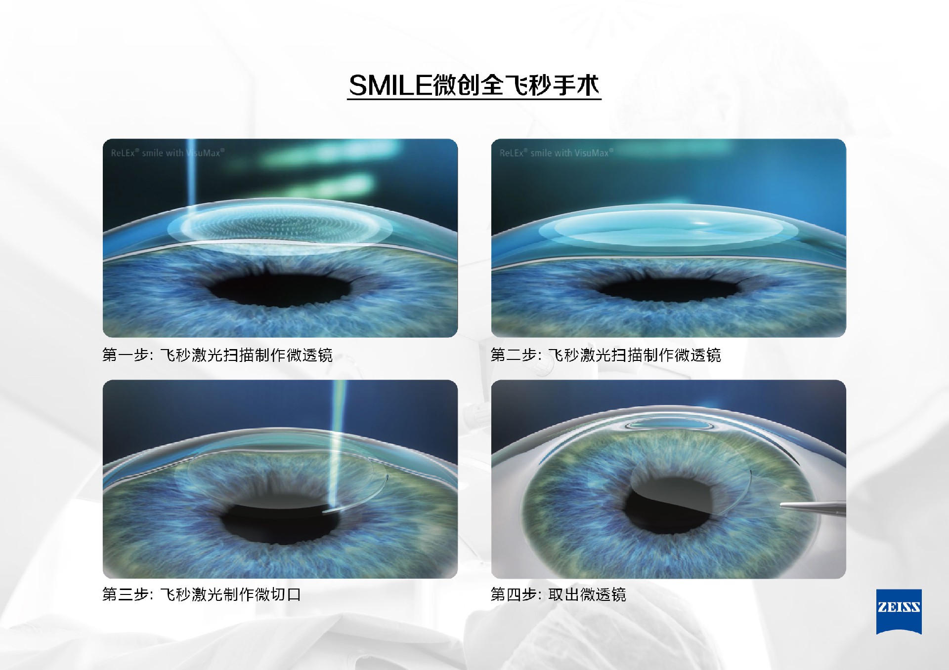 最新资讯速递 | 127届美国眼科学会（AAO）眼科成果展示