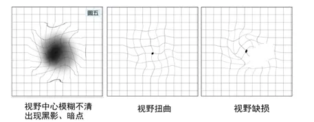 亲测有效！有没有近视、散光或老花，试看看这几张图