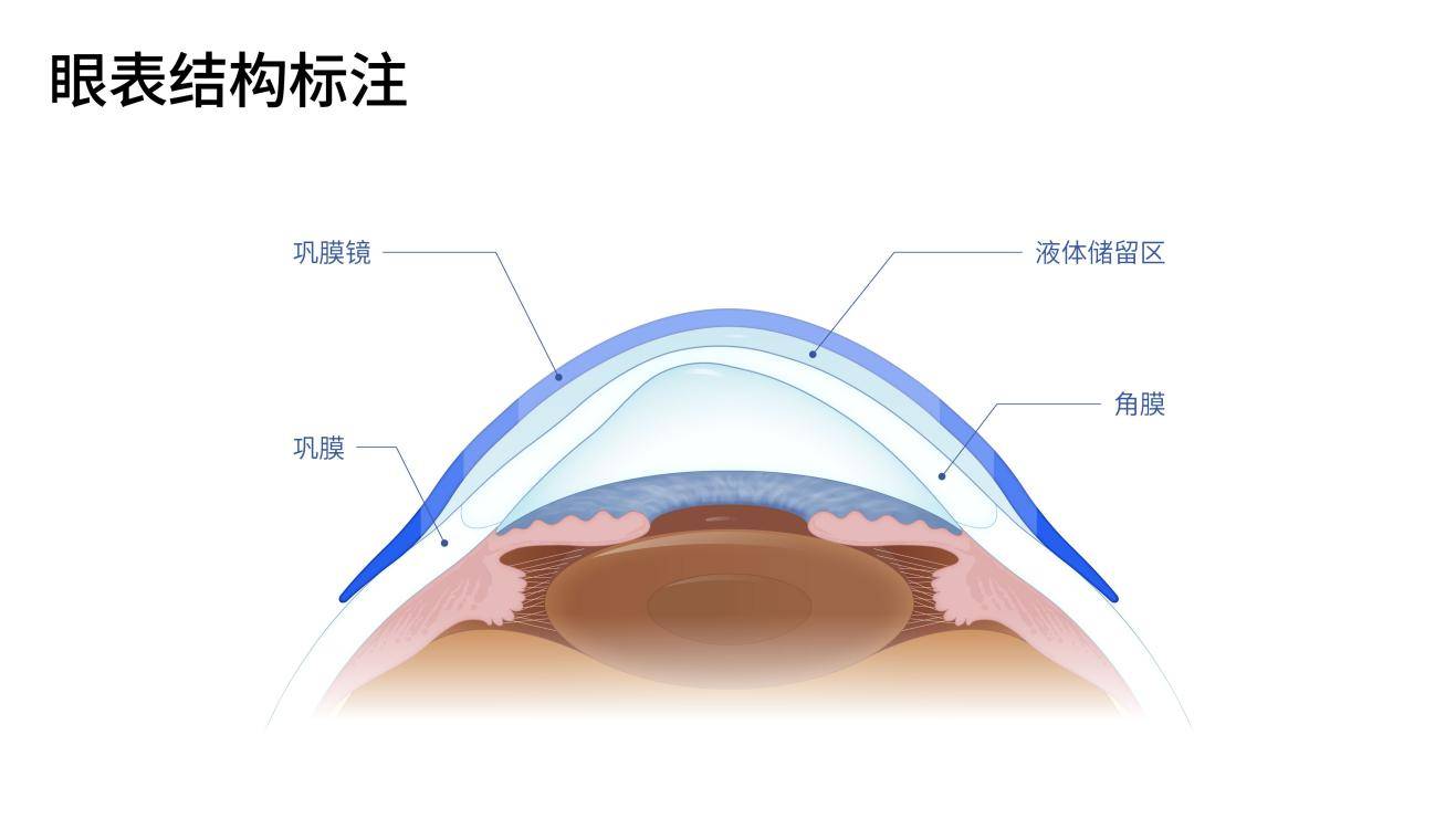 戴在眼白上，又是超大尺寸，却是隐形眼镜的“天花板”？